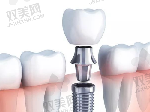 【北京房山京都惠美口腔诊所怎么预约挂号】