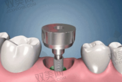 【北京圣贝口腔医院是正规的吗】