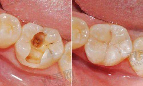 Z350和Z250耐用性差多少?哪个更能“抗造”?