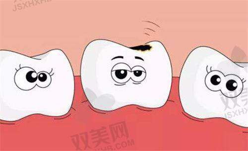 适用部位不同?哪个适合前牙?哪个更适合大牙?