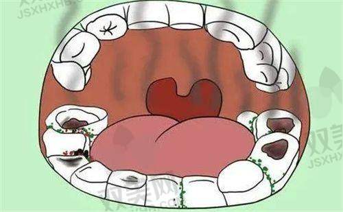 Z250和Z350价格差多少?是不是越贵越好?