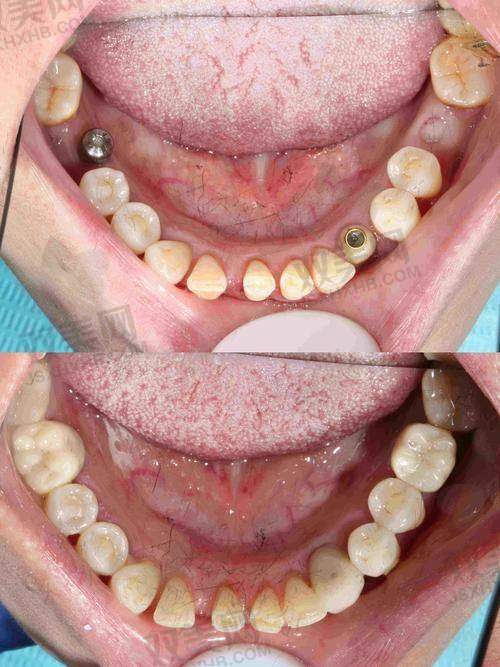 【北京房山京都惠美口腔诊所地址及乘车路线】