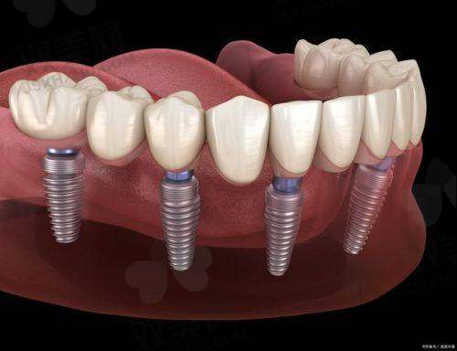 【北京有来口腔门诊门诊部擅长什么项目】