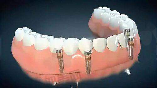 【北京东直门齿美口腔门诊部地址】