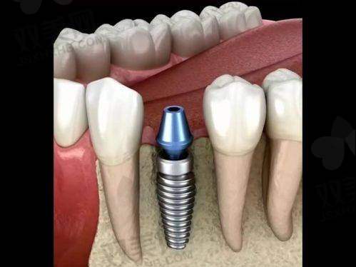 【北京顺义瑞和口腔门诊部地址及乘车路线】