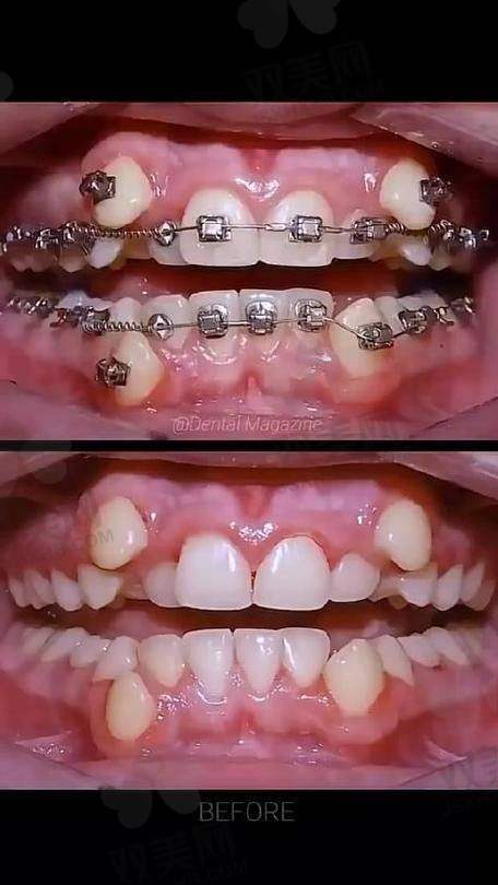 【北京诺贝加尔口腔门诊部是正规的吗】