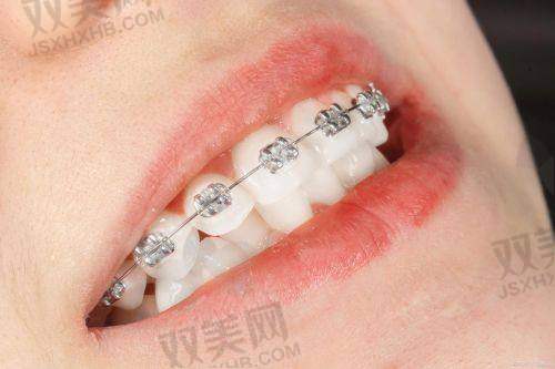 【北京圣贝口腔医院营业时间是什么时候】