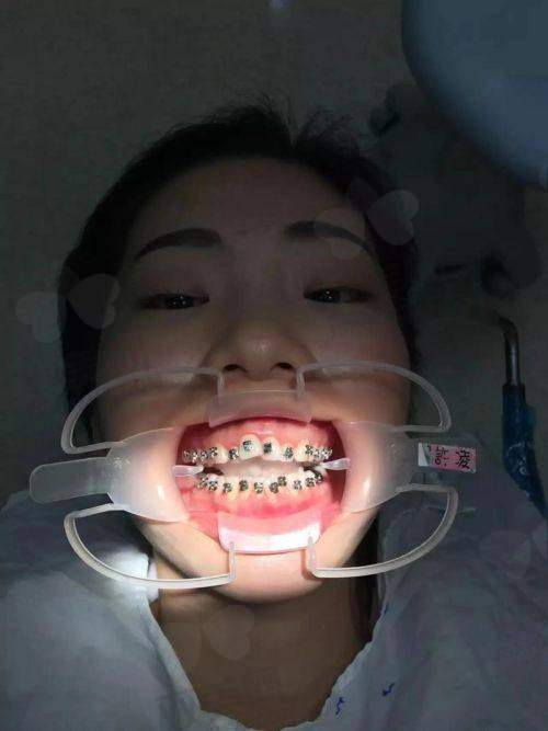 【北京圣贝口腔医院电话号码是多少】