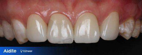 【北京诺贝加尔口腔门诊部仪器设备有哪些】