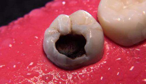 【北京微贝.芽美口腔门诊部擅长什么项目】