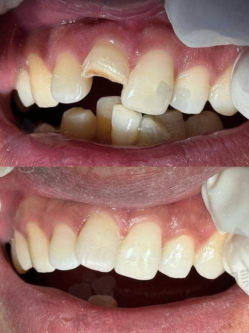 颜色逼真度PK:Z250还原4层,Z350直接36种颜色任你挑!