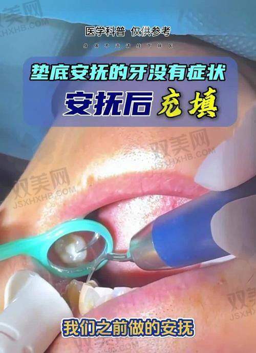 【北京微贝.芽美口腔门诊部技术特点】