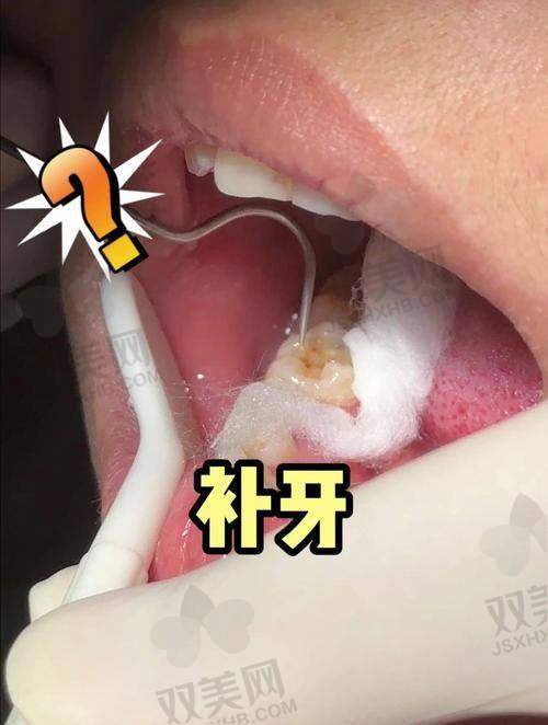 结语:预算、位置、个人体验感,选牙材真的不是看价格!