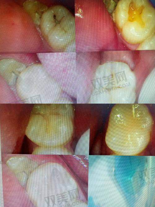 【北京微贝.芽美口腔门诊部是正规的吗】