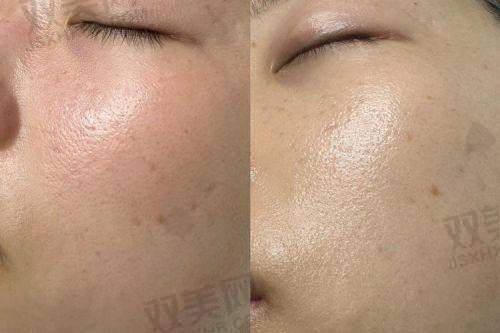 【台州路桥丽雅医疗美容门诊部仪器设备有哪些】