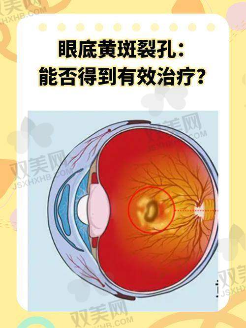 【包头市第四 医院眼科怎么样】