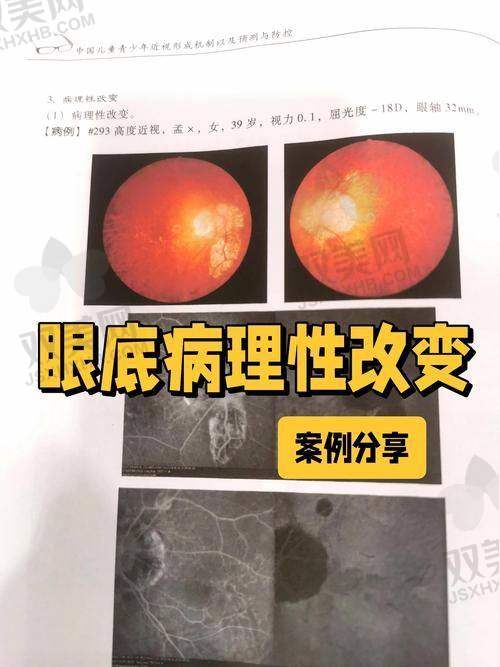 【吉林大学附属第二医院眼科仪器设备有哪些】